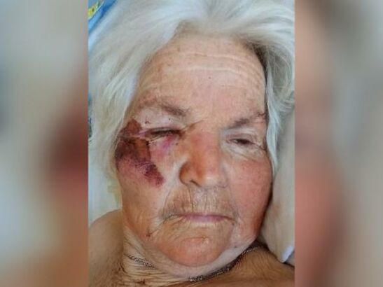 В Ростове ищут родственников немой пенсионерки, попавшей в больницу