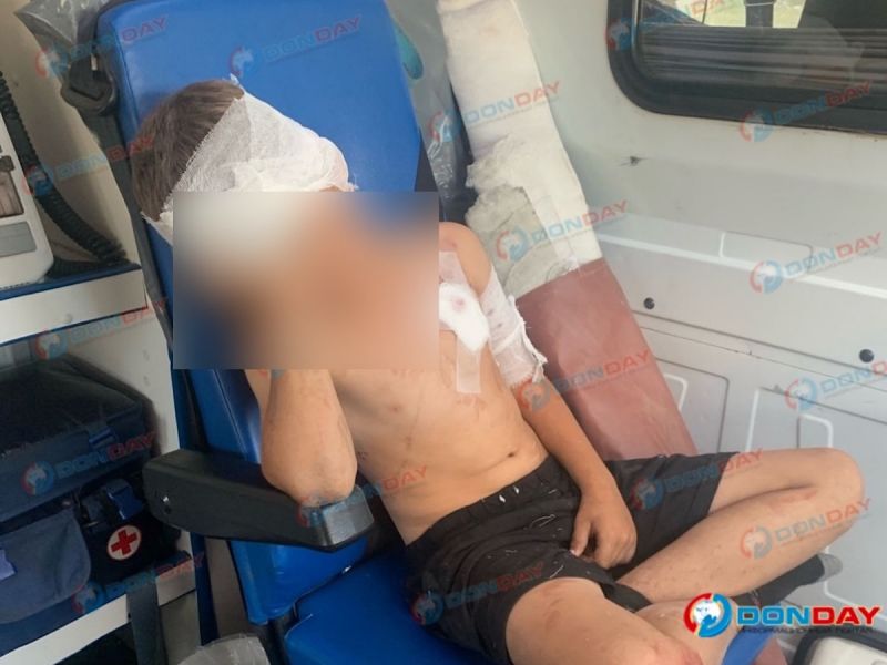 Волк напал на третьеклассника в Ростовской области