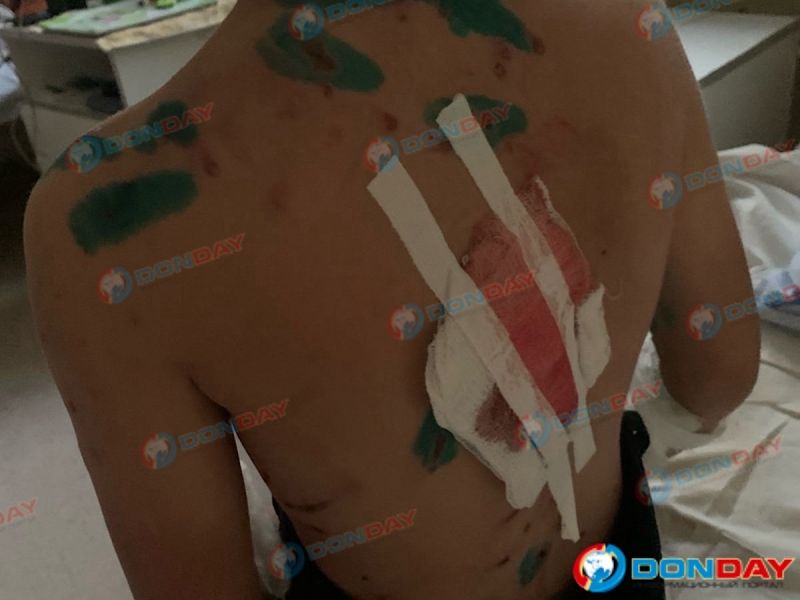 Волка, который напал на восьмилетнего мальчика в Ростовской области, усыпили