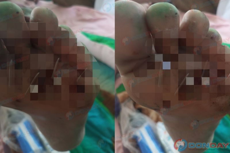 Делу об избиении жителя Новочеркасска не могут дать ход из-за отсутствия вещдоков