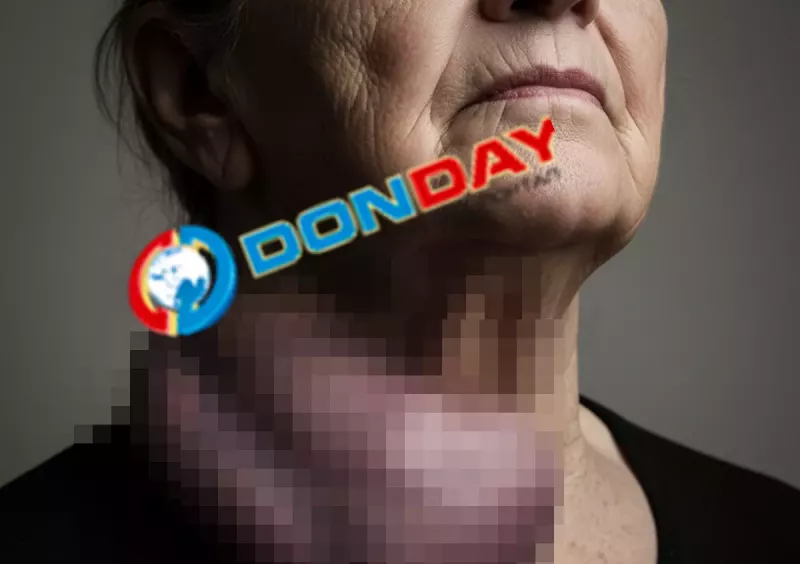 В Ростове врачи РостГМУ удалили женщине опухоль на щитовидке размером с апельсин